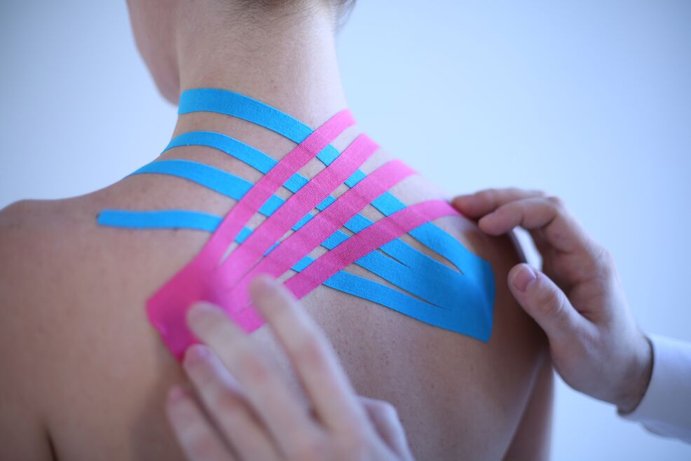 kineziotaping gerinc osteochondrosisra
