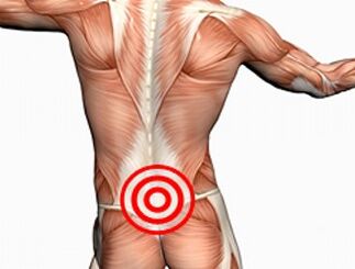 Az ágyéki gerinc osteochondrosisa