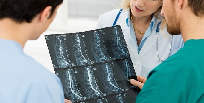 A gerinc röntgenfelvétele az osteochondrosis diagnosztizálásának egyik módja