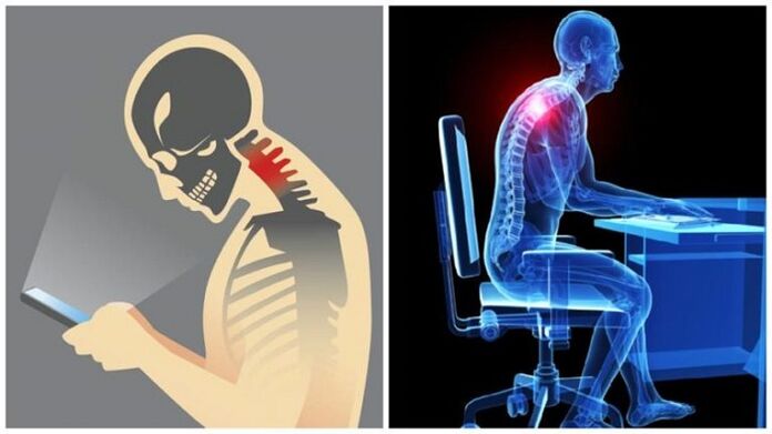 az ülő munka és a görnyedés az osteochondrosis kialakulásának okai