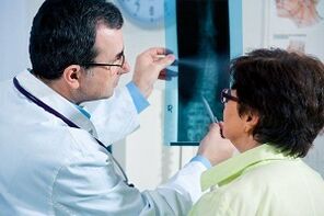 A nyaki osteochondrosis röntgendiagnosztikája